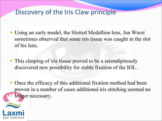 Discovery of the Iris Claw principle
 Using an early model, the Slotted Medallion lens, Jan Worst
sometimes observed that some iris tissue was caught in the slot
of his lens.
 This clasping of iris tissue proved to be a serendipitously
discovered new possibility for stable fixation of the IOL.
 Once the efficacy of this additional fixation method had been
proven in a number of cases additional iris stitching seemed no
longer necessary.
 