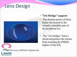 Lens Design
 “Iris Bridge” support
 The fixation points of these
lenses are located in the
virtually immobile part of
the peripheral iris
 The “iris bridges” form a
shield and protect the cornea
from touching the PMMA
haptics of the IOL.
The Iocare /ARTISAN® Aphakia IOL
 