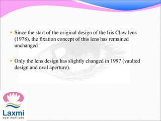  Since the start of the original design of the Iris Claw lens
(1978), the fixation concept of this lens has remained
unchanged
 Only the lens design has slightly changed in 1997 (vaulted
design and oval aperture).
 