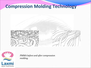 Compression Molding Technology
PMMA before and after compression
molding.
 