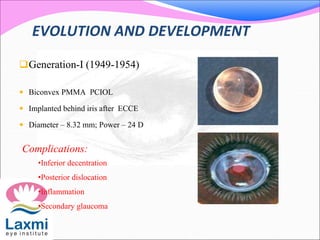 EVOLUTION AND DEVELOPMENT
Generation-I (1949-1954)
 Biconvex PMMA PCIOL
 Implanted behind iris after ECCE
 Diameter – 8.32 mm; Power – 24 D
Complications:
•Inferior decentration
•Posterior dislocation
•Inflammation
•Secondary glaucoma
 