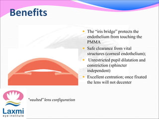 Benefits
 The “iris bridge” protects the
endothelium from touching the
PMMA
 Safe clearance from vital
structures (corneal endothelium);
 Unrestricted pupil dilatation and
constriction (sphincter
independent)
 Excellent centration; once fixated
the lens will not decenter
“vaulted” lens configuration
 
