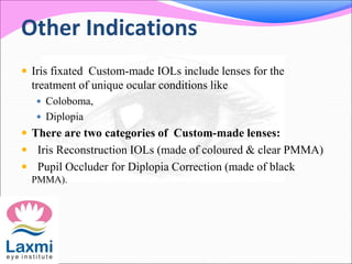 Other Indications
 Iris fixated Custom-made IOLs include lenses for the
treatment of unique ocular conditions like
 Coloboma,
 Diplopia
 There are two categories of Custom-made lenses:
 Iris Reconstruction IOLs (made of coloured & clear PMMA)
 Pupil Occluder for Diplopia Correction (made of black
PMMA).
 