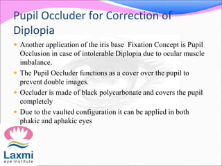Pupil Occluder for Correction of
Diplopia
 Another application of the iris base Fixation Concept is Pupil
Occlusion in case of intolerable Diplopia due to ocular muscle
imbalance.
 The Pupil Occluder functions as a cover over the pupil to
prevent double images.
 Occluder is made of black polycarbonate and covers the pupil
completely
 Due to the vaulted configuration it can be applied in both
phakic and aphakic eyes
 
