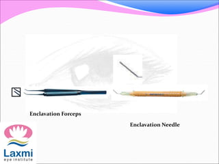 Enclavation Forceps
Enclavation Needle
 