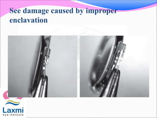 See damage caused by improper
enclavation
 