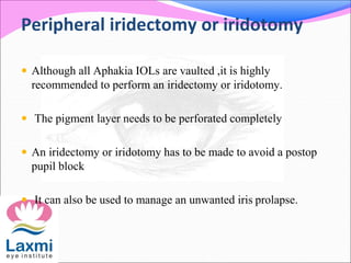 Peripheral iridectomy or iridotomy
 Although all Aphakia IOLs are vaulted ,it is highly
recommended to perform an iridectomy or iridotomy.
 The pigment layer needs to be perforated completely
 An iridectomy or iridotomy has to be made to avoid a postop
pupil block
 It can also be used to manage an unwanted iris prolapse.
 