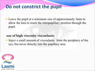 Do not constrict the pupil
 Leave the pupil at a minimum size of approximately 3mm to
allow the lens to reach the retropupillary position through the
pupil.
use of high viscosity viscoelastic
 Inject a small amount of viscoelastic from the periphery of the
eye, but never directly into the pupillary area
 