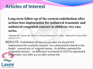 Articles of Interest
Long-term follow-up of the corneal endothelium after
artisan lens implantation for unilateral traumatic and
unilateral congenital cataract in children: two case
series.
Odenthal MT, Sminia ML, Prick LJ, Gortzak-Moorstein N, Volker -Dieben HJ. Cornea 2006;
25(10):1173-7.
RESULTS: Endothelial cell loss 10.5 yrs after iris fixated IOL
implantation for traumatic cataract was substantial & related to the
length corneal scar of original trauma . In children operated for
congenital cataract , no difference was found in CECD in operated &
unoperated eyes after 9.5 yrs after artisan iols
 