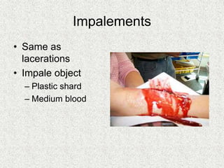 Impalements
• Same as
lacerations
• Impale object
– Plastic shard
– Medium blood
 