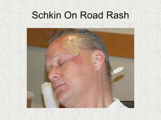 Schkin On Road Rash
 