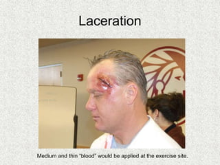 Laceration
Medium and thin “blood” would be applied at the exercise site.
 