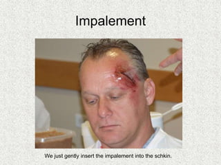 Impalement
We just gently insert the impalement into the schkin.
 