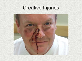 Creative Injuries
 