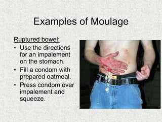 Examples of Moulage
Ruptured bowel:
• Use the directions
for an impalement
on the stomach.
• Fill a condom with
prepared oatmeal.
• Press condom over
impalement and
squeeze.
 