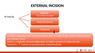 Small Incision Cataract Surgery steps.pptx