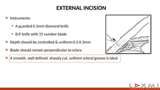 Small Incision Cataract Surgery steps.pptx
