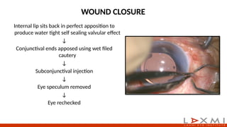 Cataract Incision Closure Small Incision Cataract Surgery steps.pptx