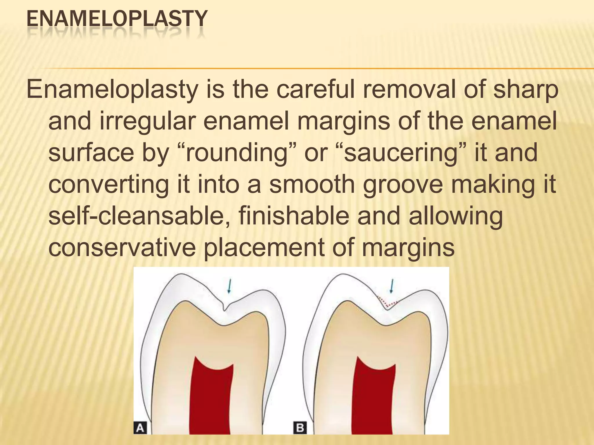 ENAMELOPLASTY

Enameloplasty is the careful removal of sharp
and irregular enamel margins of the enamel
surface by “rounding” or “saucering” it and
converting it into a smooth groove making it
self-cleansable, finishable and allowing
conservative placement of margins

 