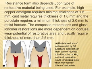 Resistance form also depends upon type of
restorative material being used. For example, high
copper amalgam requires minimal thickness of 1.5
mm, cast metal requires thickness of 1.0 mm and the
porcelain requires a minimum thickness of 2.0 mm to
resist fracture. The composite restorations and glass
ionomer restorations are more dependent on occlusal
wear potential of restorative area and usually require
thickness of more than 2.5 mm.
(A) Resistance form of
tooth provided by flat
pulpal and gingival floor,
(B) In case of rounded
pulpal floor, the rocking
motion of restoration
results in wedging force
which may result in
failure of restoration

 