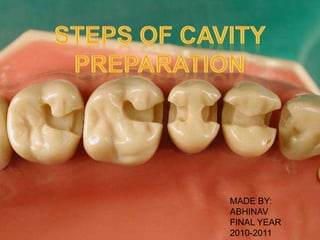 STEPS OF CAVITY PREPARATION

MADE BY:
ABHINAV
FINAL YEAR
2010-2011

 