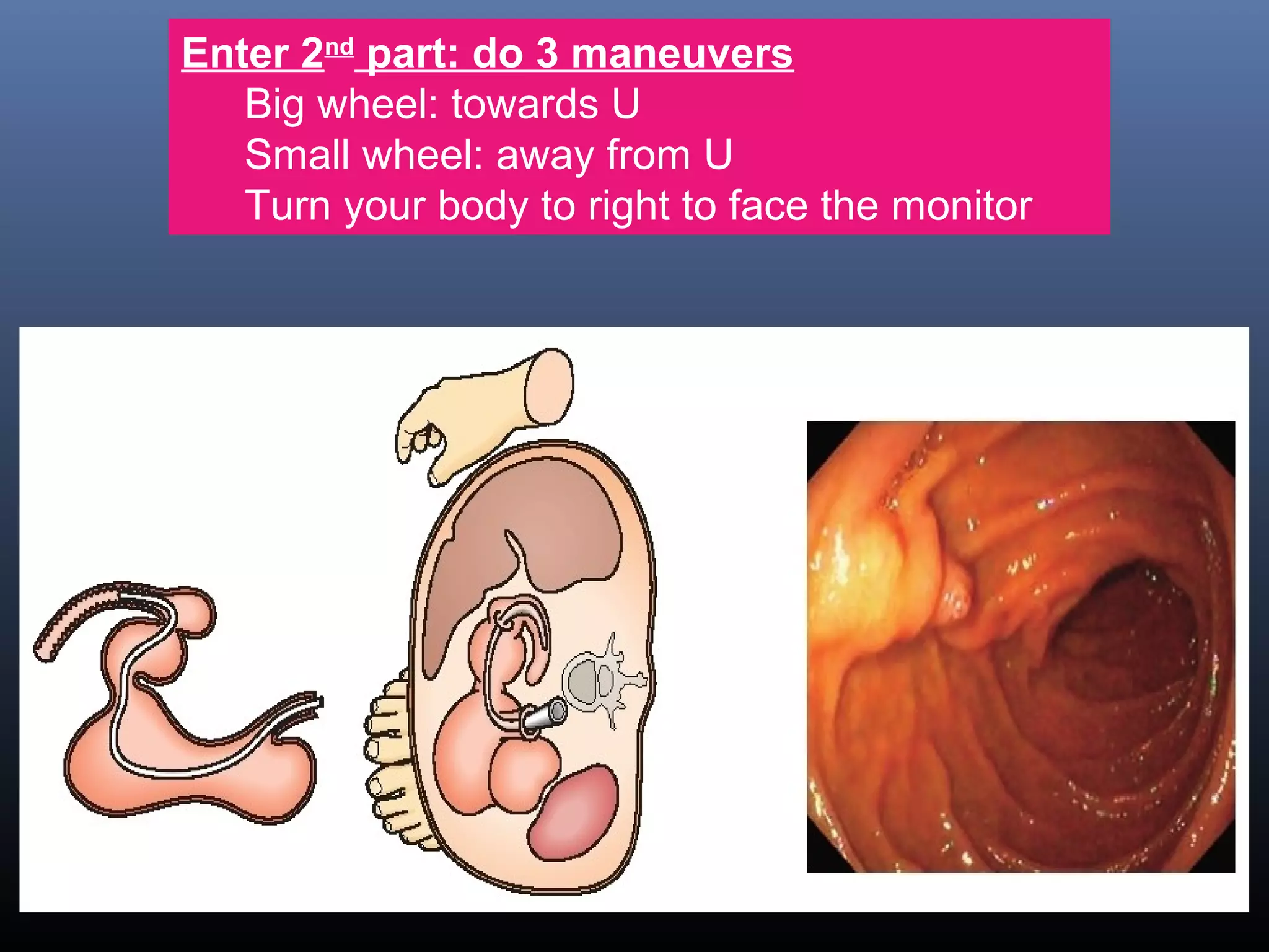 Enter 2nd
part: do 3 maneuvers
Big wheel: towards U
Small wheel: away from U
Turn your body to right to face the monitor
 