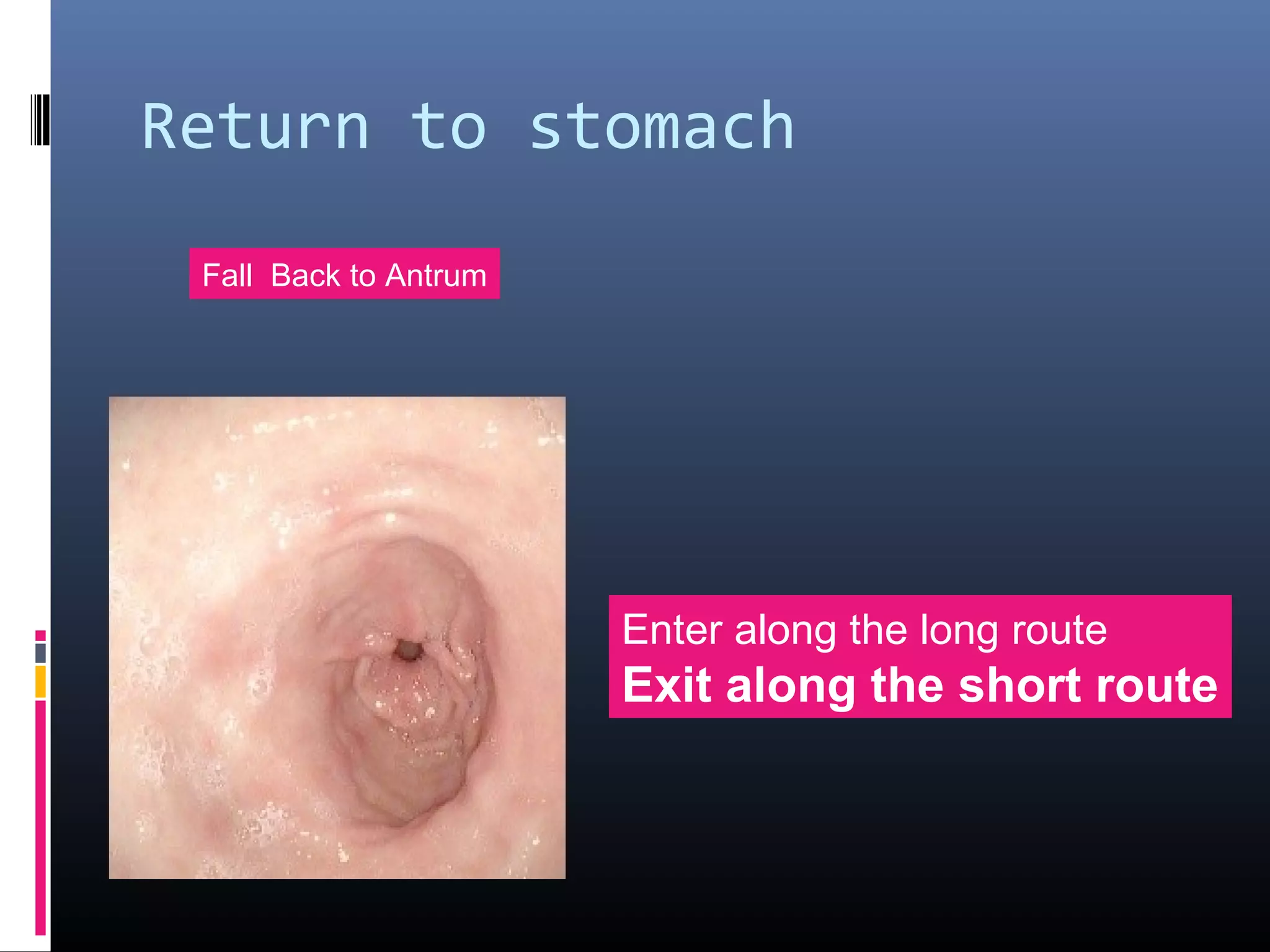 Return to stomach
Fall Back to Antrum
Enter along the long route
Exit along the short route
 