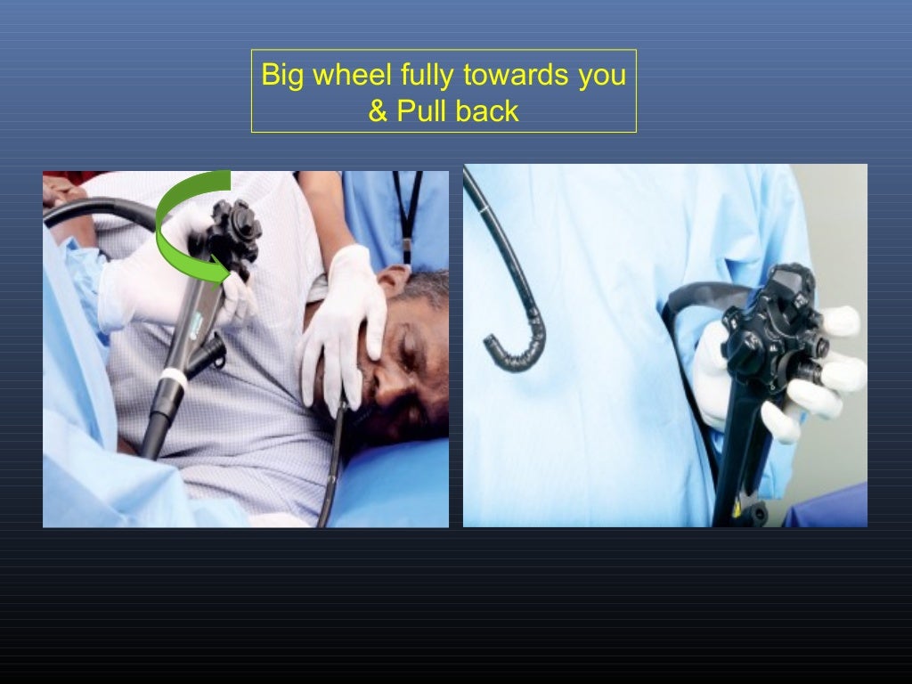 Steps of diagnostic endoscopy