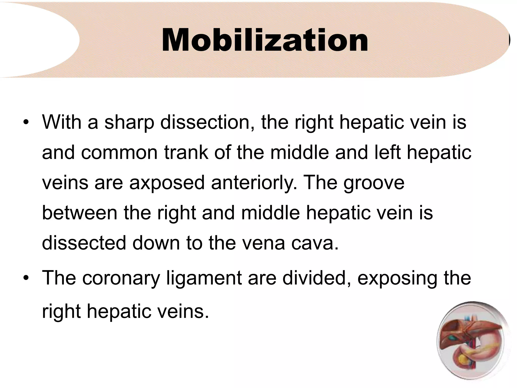 Mobilization
• With a sharp dissection, the right hepatic vein is
and common trank of the middle and left hepatic
veins are axposed anteriorly. The groove
between the right and middle hepatic vein is
dissected down to the vena cava.
• The coronary ligament are divided, exposing the
right hepatic veins.
 