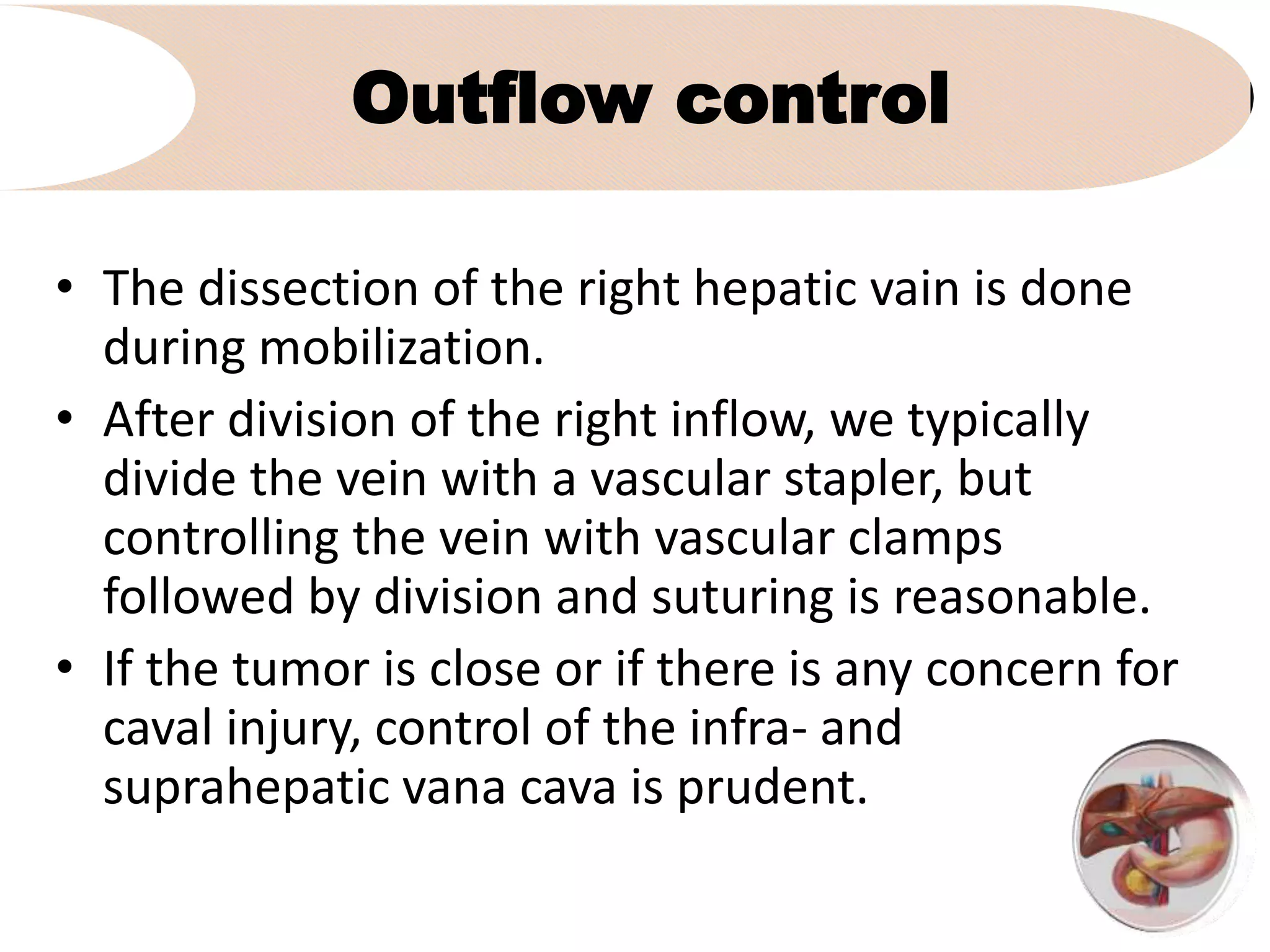 Outflow control
• The dissection of the right hepatic vain is done
during mobilization.
• After division of the right inflow, we typically
divide the vein with a vascular stapler, but
controlling the vein with vascular clamps
followed by division and suturing is reasonable.
• If the tumor is close or if there is any concern for
caval injury, control of the infra- and
suprahepatic vana cava is prudent.
 
