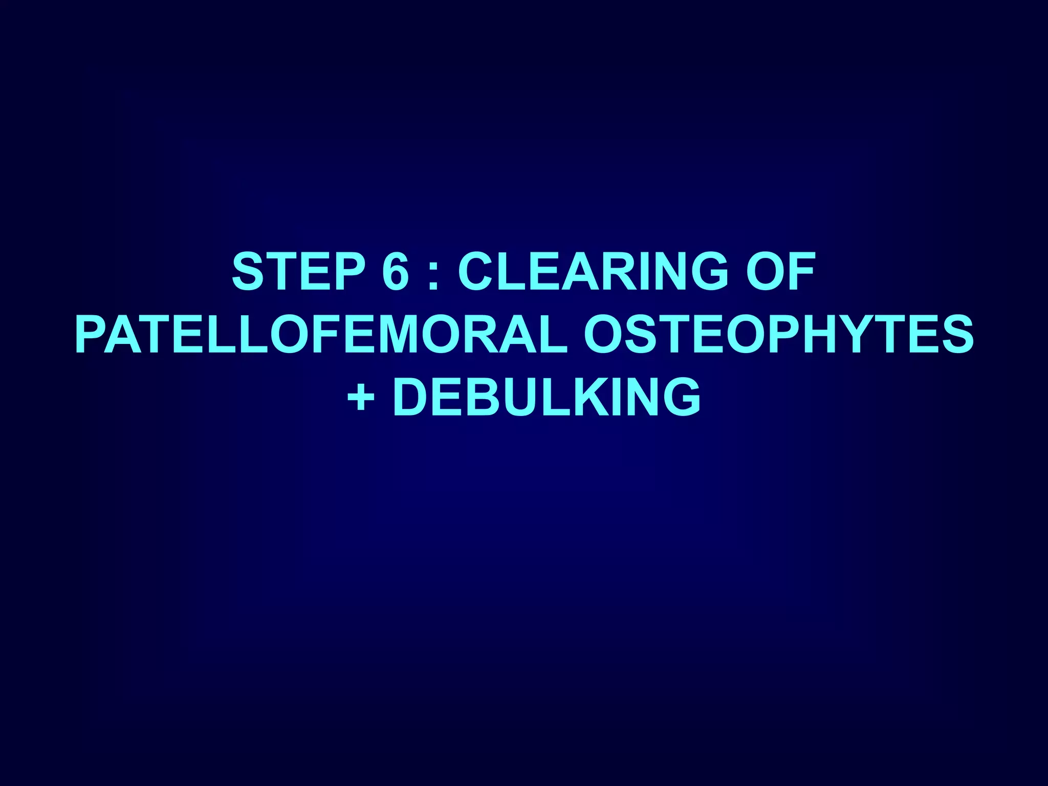 STEP 6 : CLEARING OF
PATELLOFEMORAL OSTEOPHYTES
+ DEBULKING
 