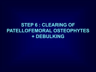 STEP 6 : CLEARING OF
PATELLOFEMORAL OSTEOPHYTES
+ DEBULKING
 