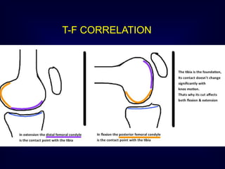 T-F CORRELATION
 