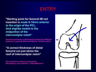 ENTRY
''Starting point for femoral IM rod
insertion is made 8-10mm anterior
to the origin of the PCL,
And slightly medial to the
midportion of the
intercondylar notch''
''A correct thickness of distal
femoral cut just skims the
roof of intercondylar notch''
Operative techniques in Orthopaedic Surgery Sam W.Wiesel
(publisher) Lippincott Williams & Wilkins 1 st Edition (2011)
Tips and tricks in total knee arthroplasty
BhavukGarg*, GauravSharma**, RajeshMalhotra***
 
