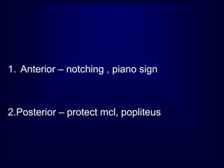 1. Anterior – notching , piano sign
2.Posterior – protect mcl, popliteus
 