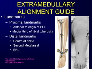 • Landmarks
– Proximal landmarks
• Anterior to origin of PCL
• Medial third of tibial tuberosity
– Distal landmarks
• Centre of ankle
• Second Metatarsal
• EHL
EXTRAMEDULLARY
ALIGNMENT GUIDE
''An aid to tibial alignment in total knee
replacement
NJ COOKE, R BURNETT''
 