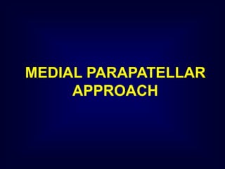 MEDIAL PARAPATELLAR
APPROACH
 