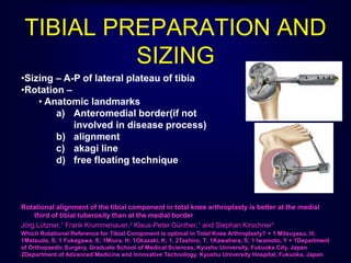 Rotational alignment of the tibial component in total knee arthroplasty is better at the medial
third of tibial tuberosity than at the medial border
Jörg Lützner,1 Frank Krummenauer,2 Klaus-Peter Günther,1 and Stephan Kirschner1
TIBIAL PREPARATION AND
SIZING
Which Rotational Reference for Tibial Component is optimal in Total Knee Arthroplasty? + 1 Mitsuyasu, H;
1Matsuda, S; 1 Fukagawa, S; 1Miura, H; 1Okazaki, K; 1, 2Tashiro, T; 1Kawahara, S; 1 Iwamoto, Y + 1Department
of Orthopaedic Surgery, Graduate School of Medical Sciences, Kyushu University, Fukuoka City, Japan
2Department of Advanced Medicine and Innovative Technology, Kyushu University Hospital, Fukuoka, Japan
•Sizing – A-P of lateral plateau of tibia
•Rotation –
• Anatomic landmarks
a) Anteromedial border(if not
involved in disease process)
b) alignment
c) akagi line
d) free floating technique
 
