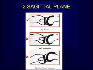 2.SAGITTAL PLANE
 