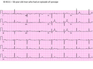 Stepwise Interpretation Ecg 12 Pptx