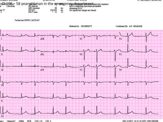 ID 108 – 58 year old man in the emergency department  
