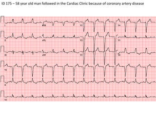 ID 175 – 58 year old man followed in the Cardiac Clinic because of coronary artery disease  