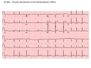 ID 383 – 76 year old woman in her family doctor’s office 