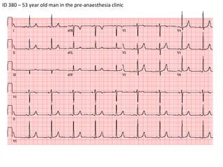 ID 380 – 53 year old man in the pre-anaesthesia clinic  