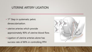 UTERINE ARTERY LIGATION
• 1ST Step in systematic pelvic
devascularisation.
• uterine arteries which provide
approximately 90% of uterine blood flow.
• Ligation of uterine arteries alone has
success rate of 80% in controlling PPH
 