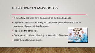 UTERO OVARIAN ANASTOMOSIS
• If the artery has been torn, clamp and tie the bleeding ends.
• Ligate the utero-ovarian artery just below the point where the ovarian
suspensory ligament joins the uterus.
• Repeat on the other side.
• Observe for continued bleeding or formation of hematoma.
• Close the abdomen in layers.
 