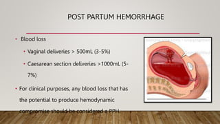 POST PARTUM HEMORRHAGE
• Blood loss
• Vaginal deliveries > 500mL (3-5%)
• Caesarean section deliveries >1000mL (5-
7%)
• For clinical purposes, any blood loss that has
the potential to produce hemodynamic
compromise should be considered a PPH.
 