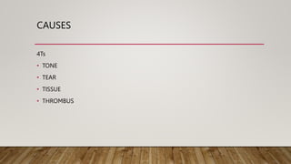 CAUSES
4Ts
• TONE
• TEAR
• TISSUE
• THROMBUS
 