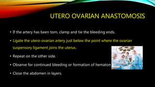 UTERO OVARIAN ANASTOMOSIS
• If the artery has been torn, clamp and tie the bleeding ends.
• Ligate the utero-ovarian artery just below the point where the ovarian
suspensory ligament joins the uterus.
• Repeat on the other side.
• Observe for continued bleeding or formation of hematoma.
• Close the abdomen in layers.
 