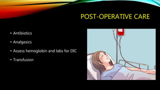 POST-OPERATIVE CARE
• Antibiotics
• Analgesics
• Assess hemoglobin and labs for DIC
• Transfusion
 